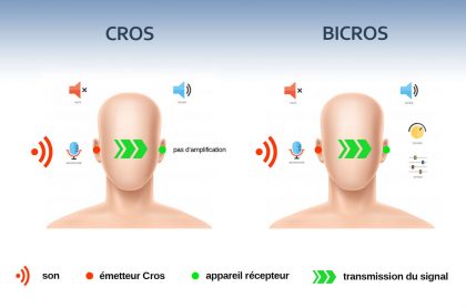 Les appareils auditifs Cros